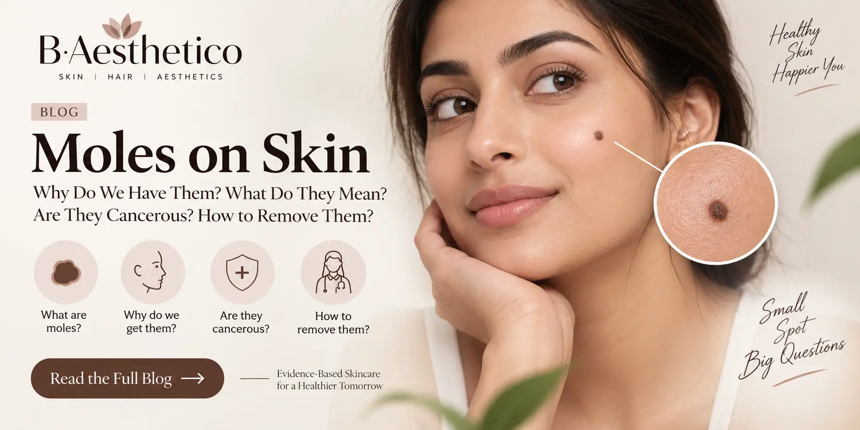 moles-on-skin-blog-banner-1.webp