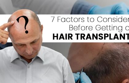 7 Factors to Consider Before Getting a Hair Transplant?