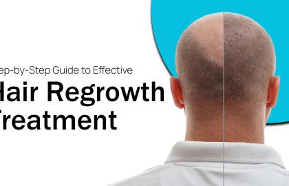 Step-by-Step Guide to Effective Hair Regrowth Treatment?